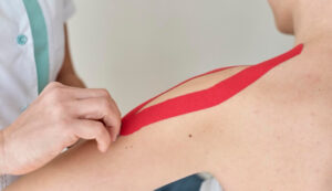 kinesio taping